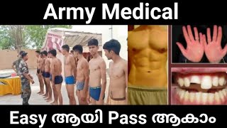 How to pass Army Medical very Easily Malayalam [upl. by Ellehcem]