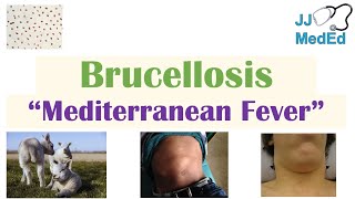 Brucellosis Mediterranean Fever  Transmission Pathogenesis Symptoms Diagnosis Treatment [upl. by Phelps911]