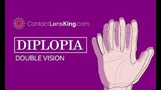 Diplopia and Double Vision  What Causes It and How is it Treated [upl. by Ulda472]