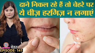 Acne Pimples दानों को बिना निशान ठीक करना है तो ये गलतियां ना करें  Sehat ep 141 [upl. by Picardi]