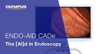 ENDOAID CADe The AId in Endoscopy  EVIS X1  Gastroenterology  OLYMPUS [upl. by Glantz]