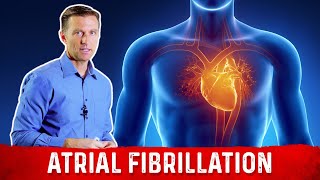 The Best Atrial Fibrillation Guidelines – Dr Berg [upl. by Aikan]