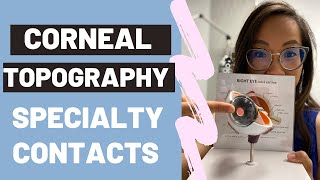 Specialty Contact Lenses Corneal Topography [upl. by Etteneg]