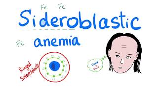 Sideroblastic Anemia [upl. by Zoe]