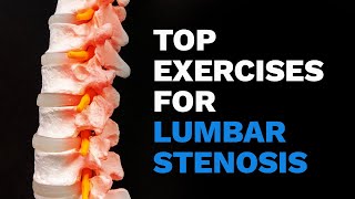 Top exercises for Lumbar Stenosis [upl. by Noll193]