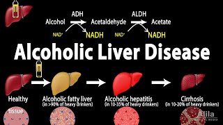 Alcoholic Liver Disease Animation [upl. by Giesecke]