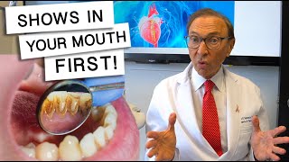 5 Diseases That Show Signs In Your Mouth [upl. by Henke766]