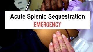 Sickle Cell Splenic Sequestration Emergency [upl. by Carmelita195]