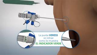 KIT TORACOCENTESIS DRENTECH UNICO FRMEDICAL MARCA REDAX [upl. by Evangeline]