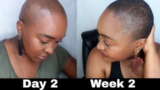 BALD HEAD SCALP CARE  Wash Routine  Hair Growth  Yemu [upl. by Aihsinat894]