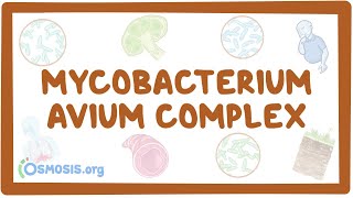 Mycobacterium avium complex  causes symptoms diagnosis treatment pathology [upl. by Orsa63]