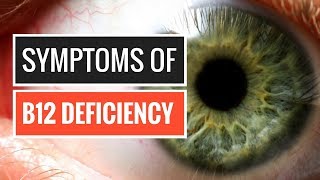 5 Signs and Symptoms of Vitamin B12 Deficiency [upl. by Edan846]