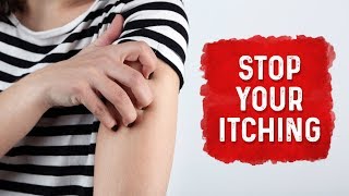 What Causes Hives and Itchiness  Urticaria Hives Treatment  Dr Berg [upl. by Mayworm]