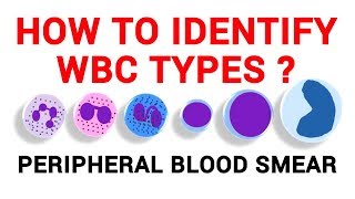 Complete Blood Count  CBC Interpretation Leukocytosis [upl. by O'Driscoll292]