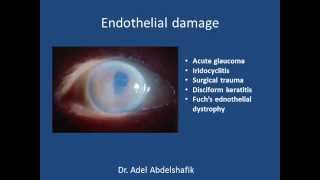 Cornea  1 anatomy [upl. by Blynn]