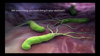 H pylori Symptoms amp Diagnostic Testing [upl. by Ueihtam]