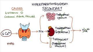 Understanding Hyperparathyroidism [upl. by Buschi]