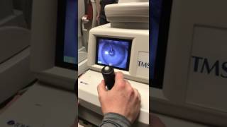 Tomey TMS4 corneal topography [upl. by Nnylekoorb]