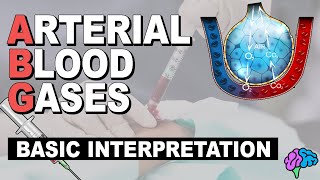 Basic ABG Interpretation  Arterial Blood Gases Part 3 [upl. by Carine]