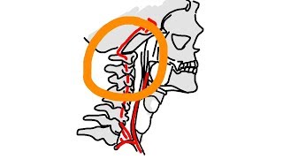 Studie Chiropraktik und Schlaganfälle [upl. by Gudrun]