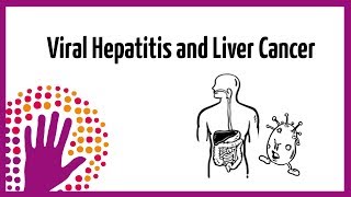 Viral Hepatitis and Liver Cancer [upl. by Durman]