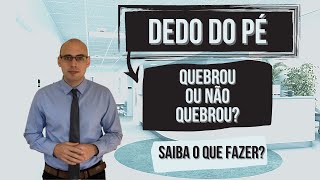 DEDO DO PÉ QUEBROU OU ACHA QUE QUEBROU ASSISTA [upl. by Patton241]