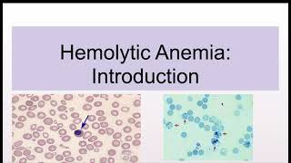 Hemolytic Anemias Introduction and Classification [upl. by Adnilreb808]