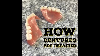 How Dentures Are RepairedFixed [upl. by Cirilla]