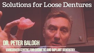 Solutions for Loose Dentures  VCCID [upl. by Naginarb]