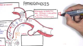 Malaria Pathophysiology [upl. by Ordnazil]