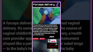 Forceps delivery [upl. by Riva]