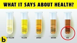 What The Color Of Your Urine Says About Your Health [upl. by Akers]