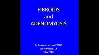 FIBROIDS AND ADENOMYOSIS [upl. by Odlanyer]