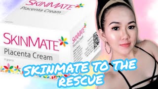 SKINMATE PLACENTA CREAM  FULL HONEST REVIEW [upl. by Imiaj]