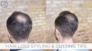 How To Cut amp Style Balding or Thinning Hair [upl. by Karissa]