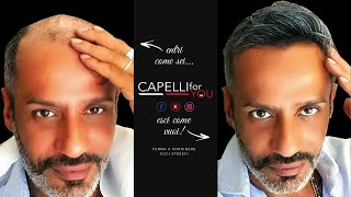 Applicazione Protesi Capillare 5° Dimensione Capelli for You [upl. by Wilber]