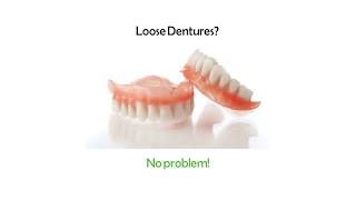 Denture Reline Kit  Perma Laboaratories [upl. by Oeniri]