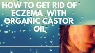 How To Get Rid OF Eczema Naturally With CASTOR OIL [upl. by Rucker]