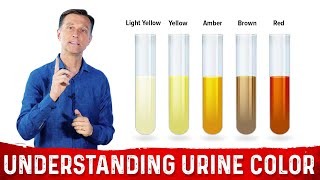 What Urine Color Indicates About Your Body – DrBerg [upl. by Zebadiah]