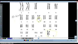 Karyotype analysis [upl. by Skelly]