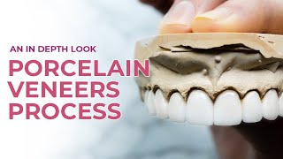 Porcelain Veneers A Dental Boutique Process  An In Depth Look [upl. by Tinaret41]