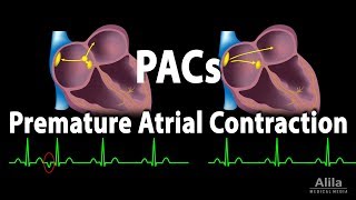 CONTRACTIONS  When To Go To Hospital [upl. by Jocelin56]