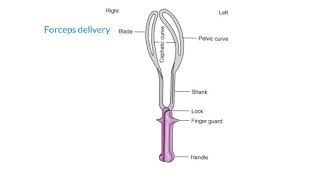 Forceps delivery indications Contraindication and re quest [upl. by Virgel986]