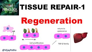 TISSUE REPAIR Part 1 Repair  Regeneration [upl. by Macleod]