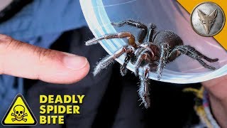 DEADLIEST SPIDER BITE [upl. by Redlac]