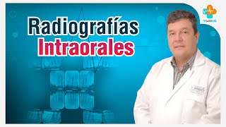 Radiografías Intraorales  Tu Salud Guía [upl. by Ranie981]