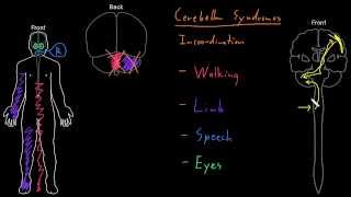 Syndrome Cerebellar syndromes [upl. by Manoff831]