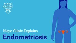 Treatment of Endometriosis [upl. by Noell219]