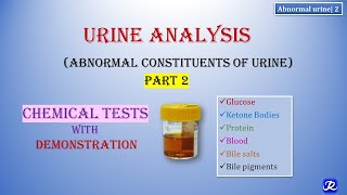 2 Abnormal Urine  Part 2  Urine Analysis  Chemical Tests  Biochemistry  NJOY Biochemistry [upl. by Tonkin]