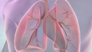 Symptoms of lung cancer [upl. by Anairo]